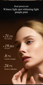 Hot Selling Blacken DPL Photofacial Skincare Device PIR Skin Whitening  Brightening Anti-ageing Rejuvenation Device PRO