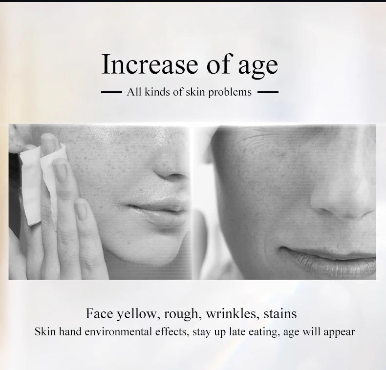 Hot Selling Blacken DPL Photofacial Skincare Device PIR Skin Whitening  Brightening Anti-ageing Rejuvenation Device PRO